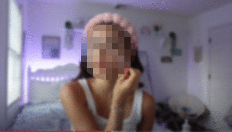 틱톡 따라하다 피부 망친다?